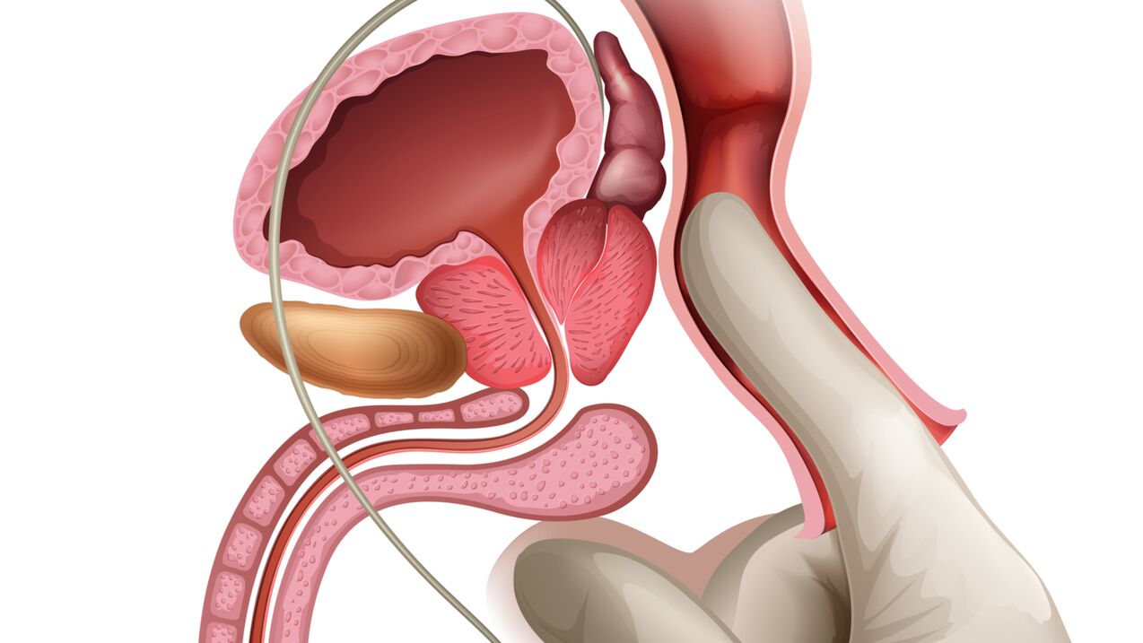Prostate massage is an effective way to treat stagnant prostatitis