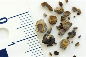 stones
